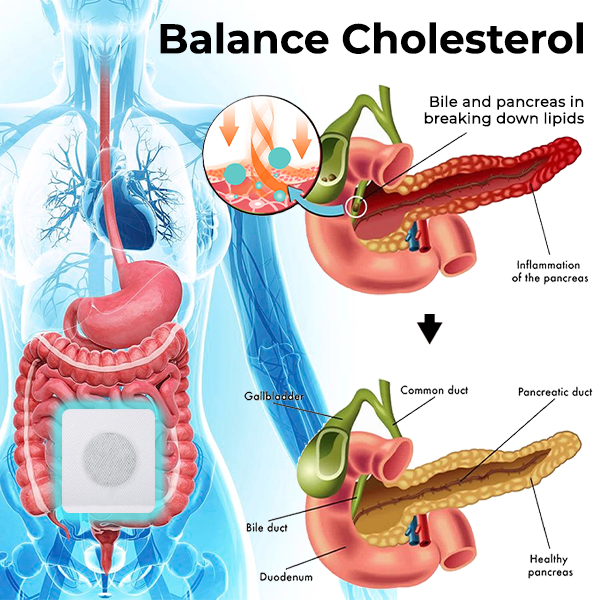 Oveallgo™ Patch ventral équilibrant le cholestérol pour l’hyperlipidémie