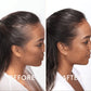 Oveallgo™ Capuchon de thérapie laser mobile pour la repousse des cheveux