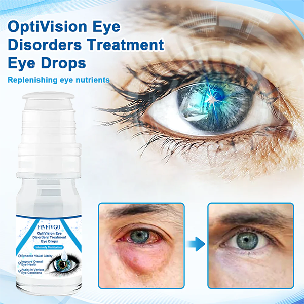 Oveallgo™ OptiVision Gouttes oculaires pour le traitement des troubles oculaires