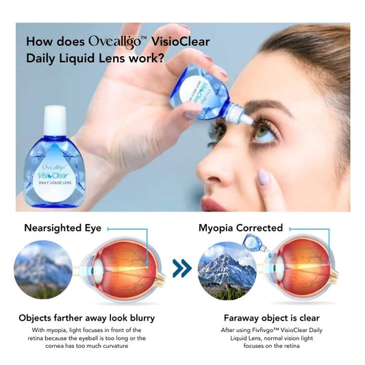 Oveallgo™ Lentille liquide quotidienne AquaVision