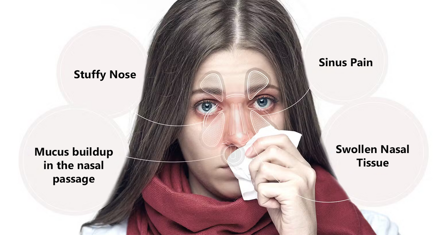 iRosesilk™ Appareil de thérapie nasale BreathEase