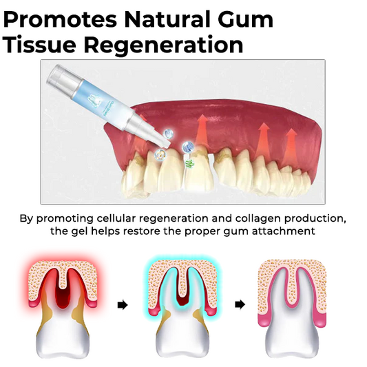 Oveallgo™ Gum Shield Gel thérapeutique